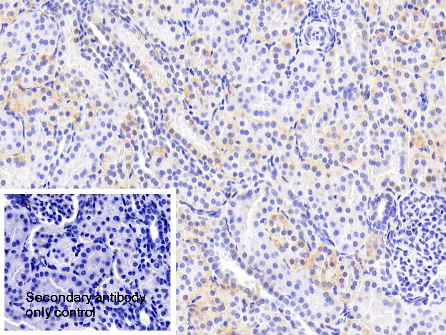 Polyclonal Antibody to Uridine Phosphorylase 1 (UPP1)