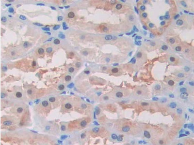 Polyclonal Antibody to Beta Secretase 2 (BACE2)