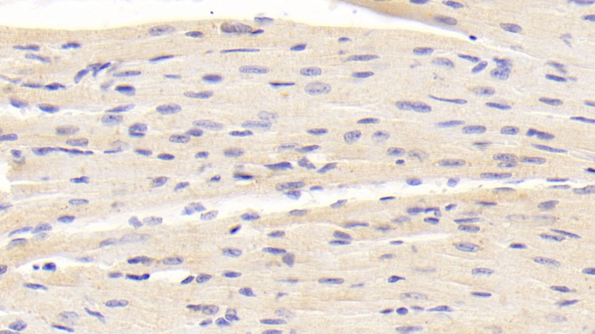 Polyclonal Antibody to Beta Secretase 2 (BACE2)