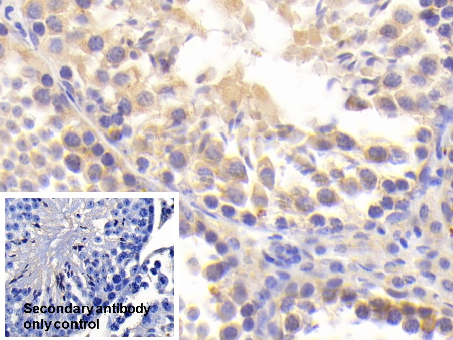 Polyclonal Antibody to Beta Secretase 2 (BACE2)