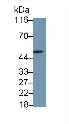 Polyclonal Antibody to Interleukin 6 Receptor (IL6R)