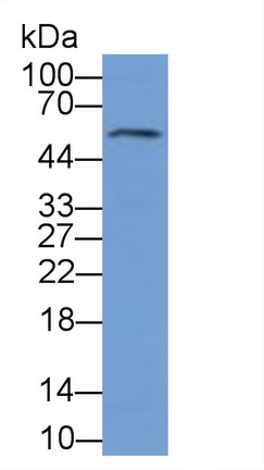 Polyclonal Antibody to Interleukin 6 Receptor (IL6R)