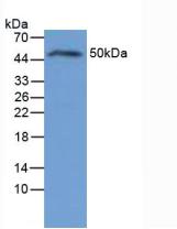 Polyclonal Antibody to Interleukin 6 Receptor (IL6R)