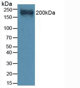 Polyclonal Antibody to Versican (VCAN)