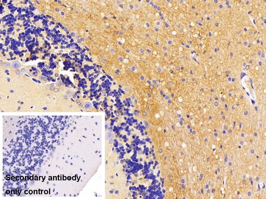 Polyclonal Antibody to Versican (VCAN)