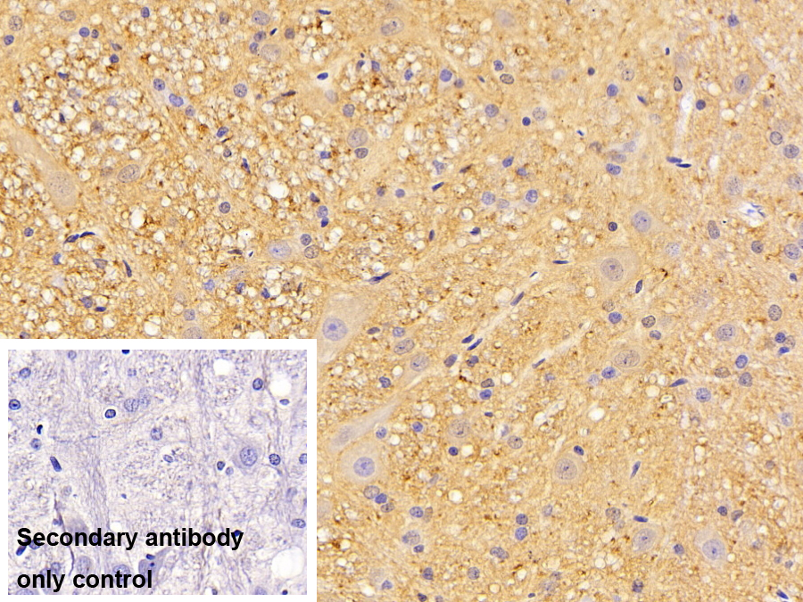 Polyclonal Antibody to Versican (VCAN)