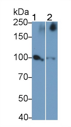 Polyclonal Antibody to Vascular Endothelial Growth Factor Receptor 1 (VEGFR1)