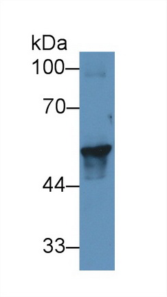 Polyclonal Antibody to Cytokeratin 17 (CK17)