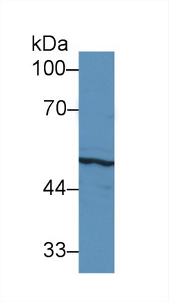 Polyclonal Antibody to Cytokeratin 17 (CK17)