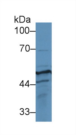 Polyclonal Antibody to Cytokeratin 17 (CK17)