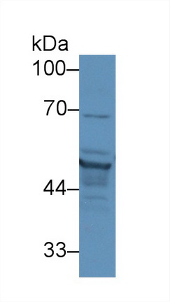 Polyclonal Antibody to Cytokeratin 17 (CK17)