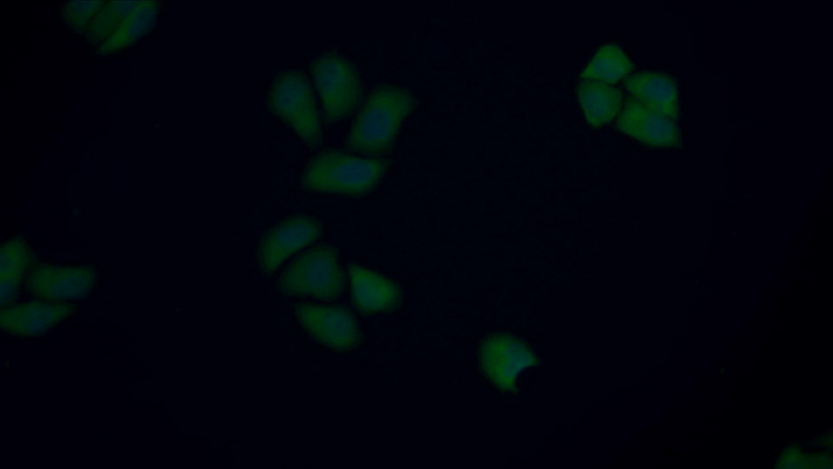 Polyclonal Antibody to Cytokeratin 17 (CK17)