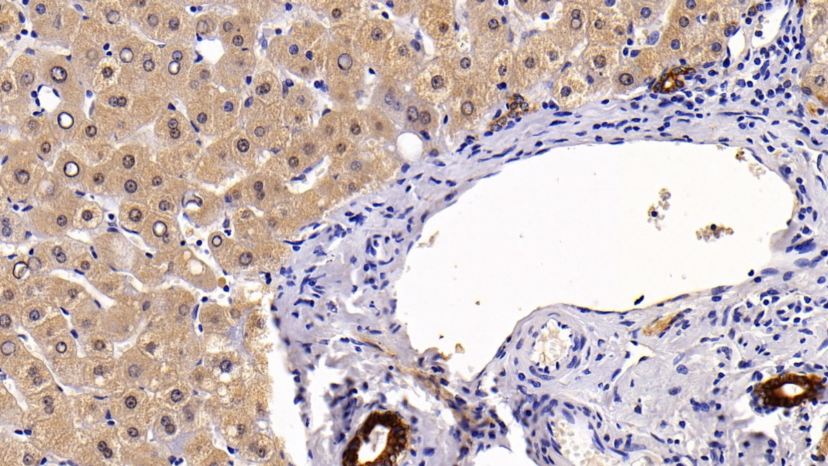 Polyclonal Antibody to Cytokeratin 17 (CK17)