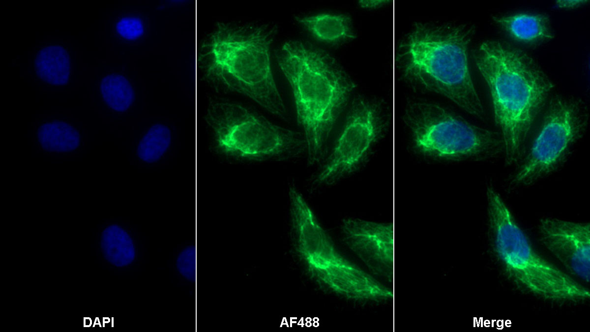 Polyclonal Antibody to Cytokeratin 17 (CK17)