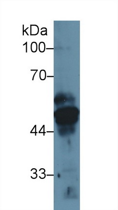 Polyclonal Antibody to Cytokeratin 17 (CK17)