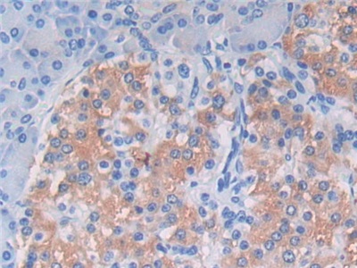 Polyclonal Antibody to Complement Component 9 (C9)