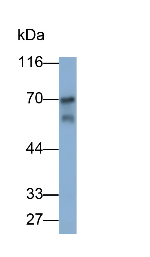 Polyclonal Antibody to Complement Component 9 (C9)