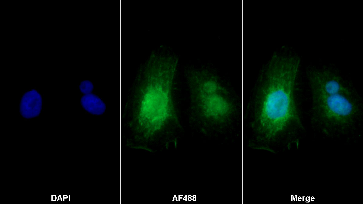 Polyclonal Antibody to Nuclear Factor Kappa B (NFkB)