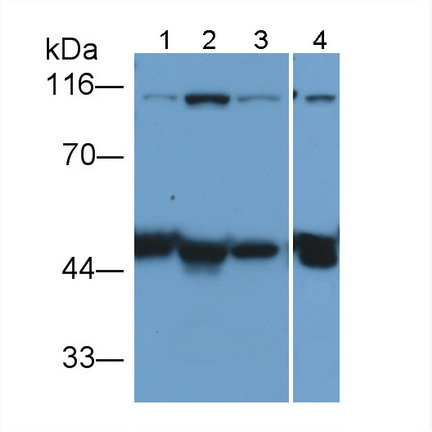 Polyclonal Antibody to Nuclear Factor Kappa B (NFkB)