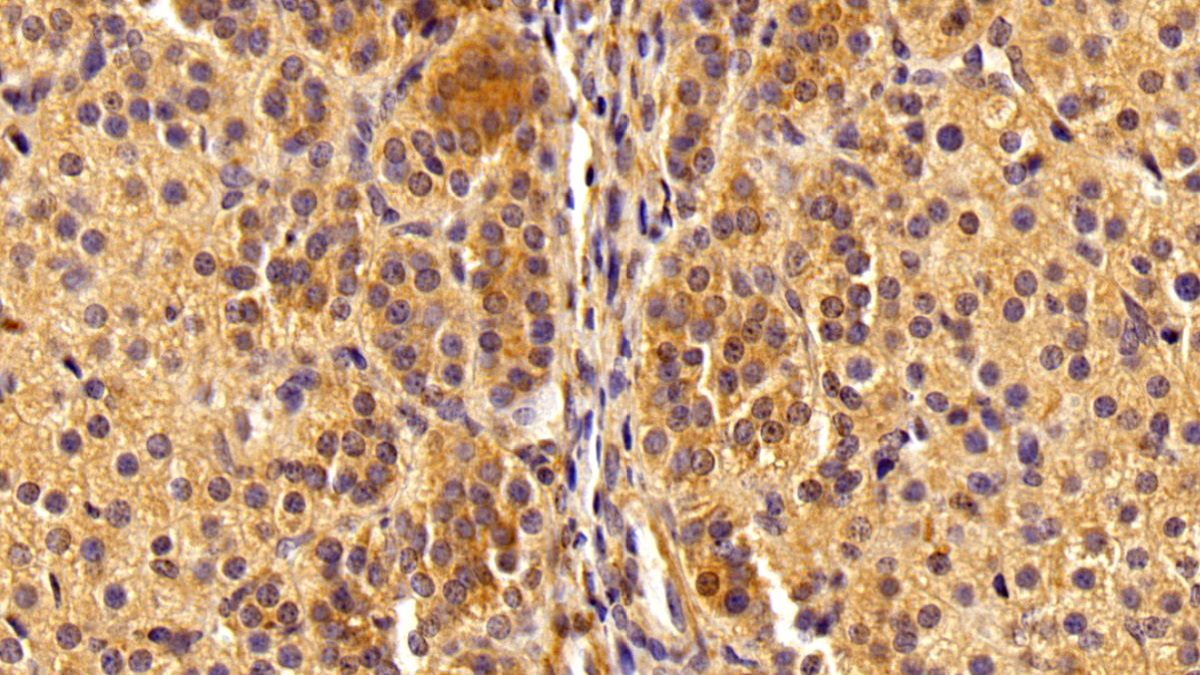 Polyclonal Antibody to Nuclear Factor Kappa B (NFkB)