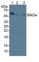 Polyclonal Antibody to Nuclear Factor Kappa B (NFkB)