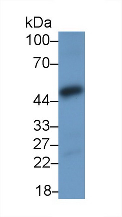 Polyclonal Antibody to Nuclear Factor Kappa B (NFkB)