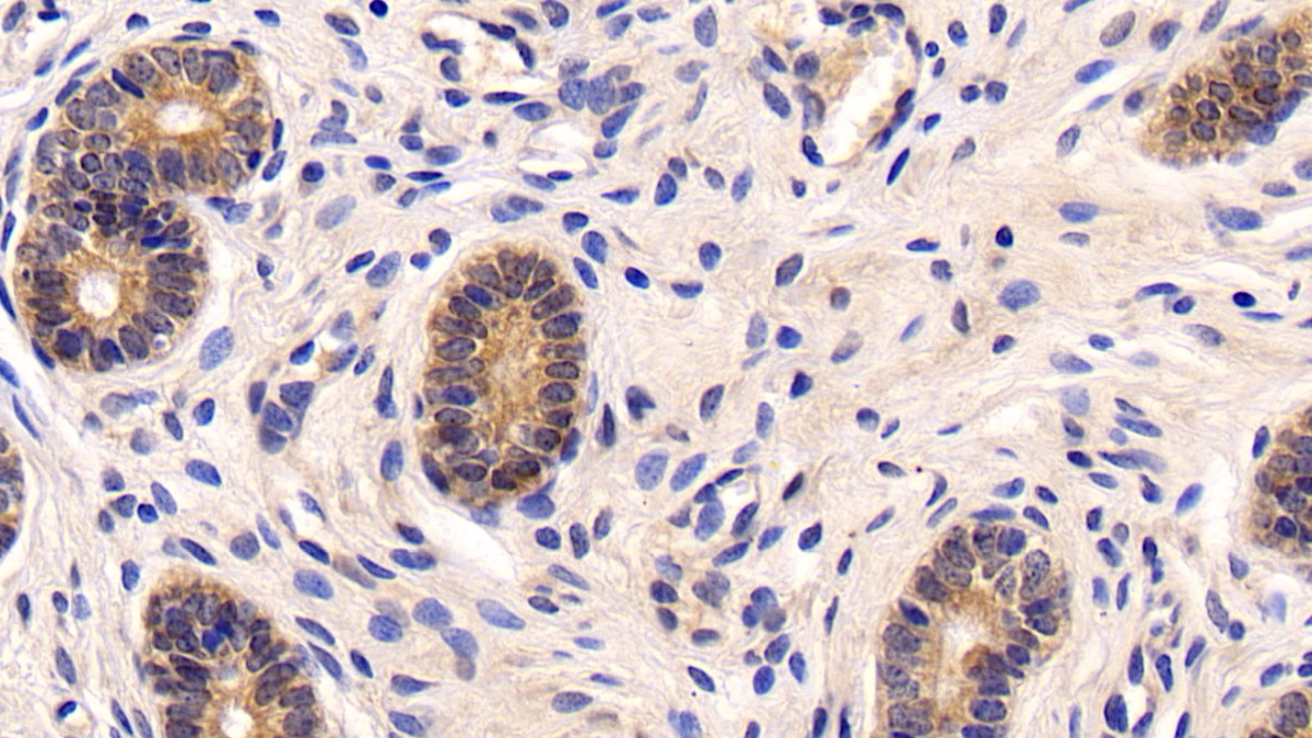 Polyclonal Antibody to Nuclear Factor Kappa B (NFkB)