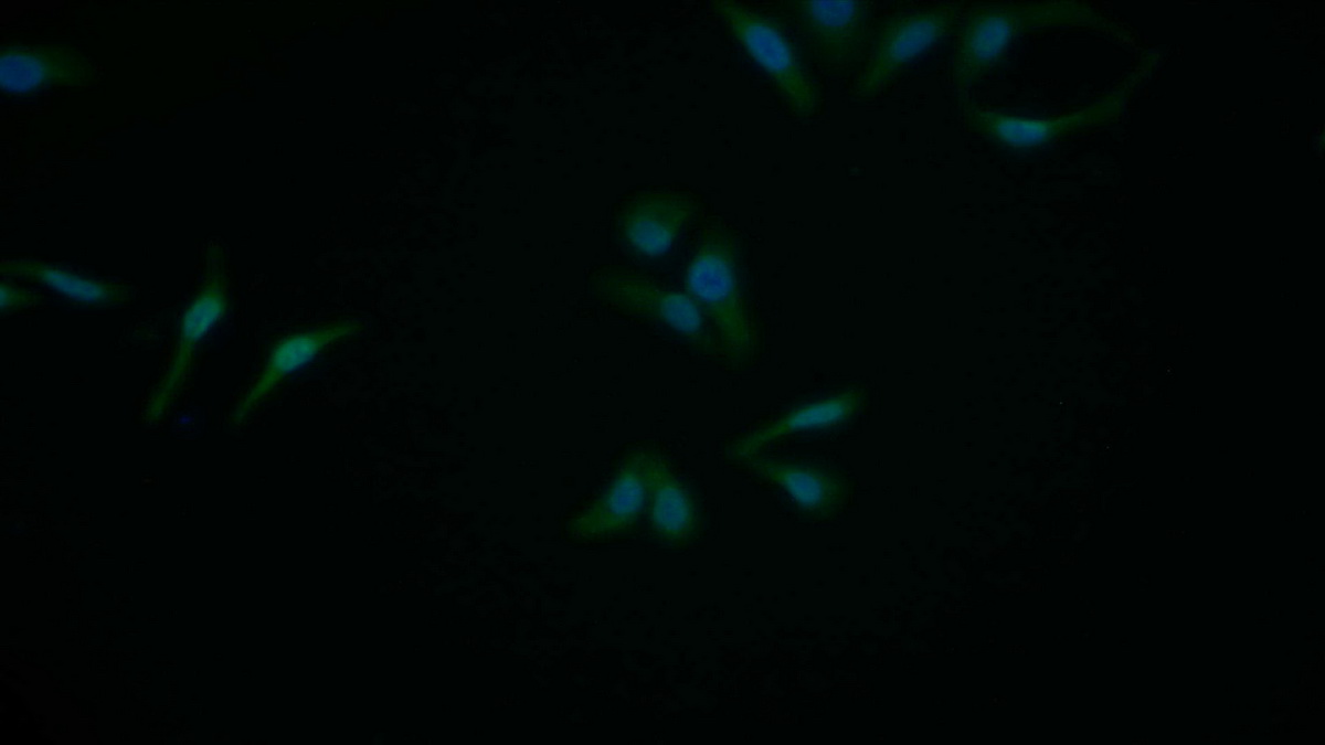 Polyclonal Antibody to Nuclear Factor Kappa B (NFkB)