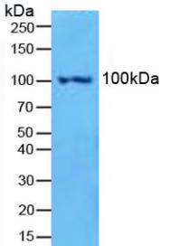 Polyclonal Antibody to Nuclear Factor Kappa B2 (NFkB2)