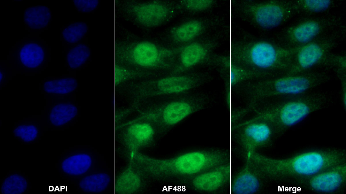 Polyclonal Antibody to V-Rel Reticuloendotheliosis Viral Oncogene Homolog B (RELB)