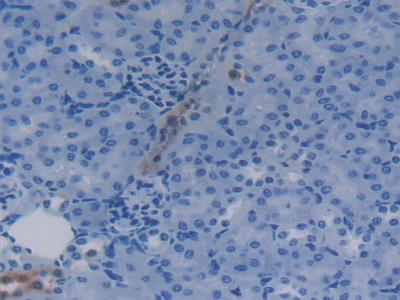 Polyclonal Antibody to Apolipoprotein C4 (APOC4)