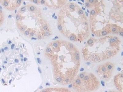 Polyclonal Antibody to A Disintegrin And Metalloprotease 9 (ADAM9)