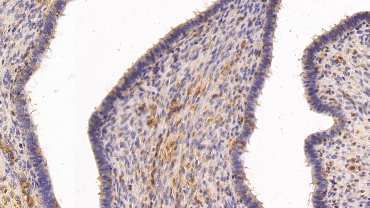 Polyclonal Antibody to Transglutaminase 2 (TGM2)