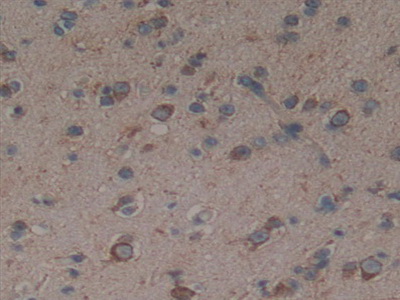 Polyclonal Antibody to Hedgehog Homolog, Sonic (SHH)