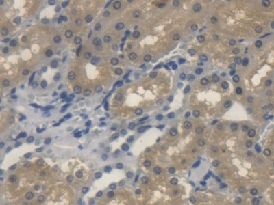 Polyclonal Antibody to Hedgehog Homolog, Sonic (SHH)