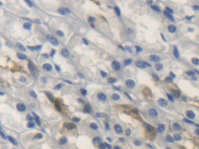 Polyclonal Antibody to Hedgehog Homolog, Sonic (SHH)