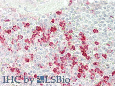 Polyclonal Antibody to Complement Factor D (CFD)