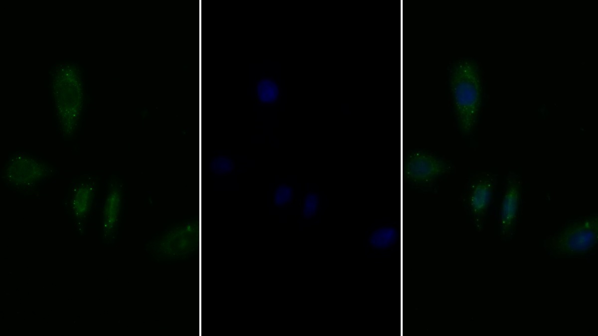 Polyclonal Antibody to Interleukin 2 Receptor Alpha (IL2Ra)