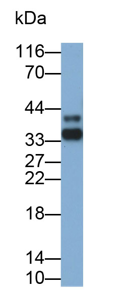 Polyclonal Antibody to Interleukin 2 Receptor Alpha (IL2Ra)