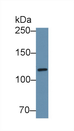 Polyclonal Antibody to Vinculin (VCL)