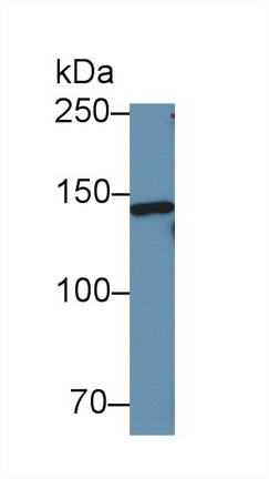 Polyclonal Antibody to Vinculin (VCL)