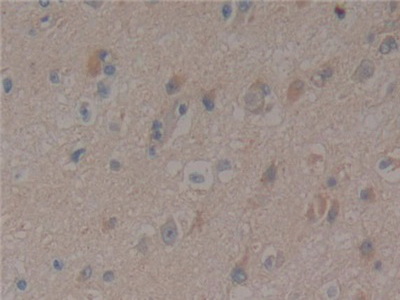 Polyclonal Antibody to Paxillin (PXN)