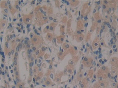 Polyclonal Antibody to Paxillin (PXN)