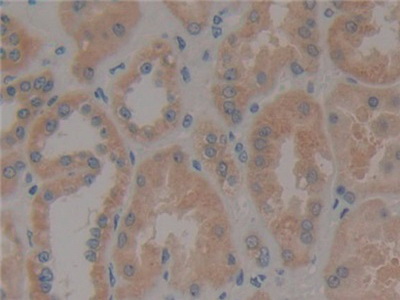 Polyclonal Antibody to Paxillin (PXN)