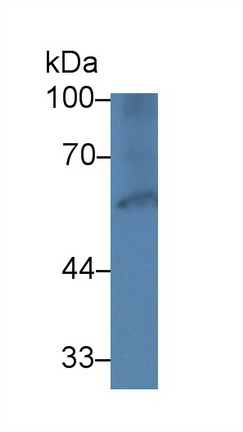 Polyclonal Antibody to Paxillin (PXN)