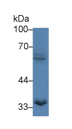 Polyclonal Antibody to Paxillin (PXN)