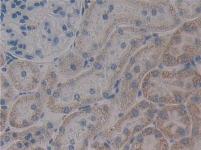 Polyclonal Antibody to Paxillin (PXN)