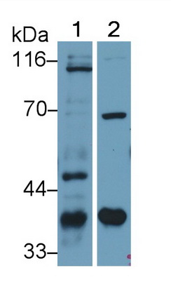 Polyclonal Antibody to Inhibitory Subunit Of NF Kappa B Alpha (IkBa)