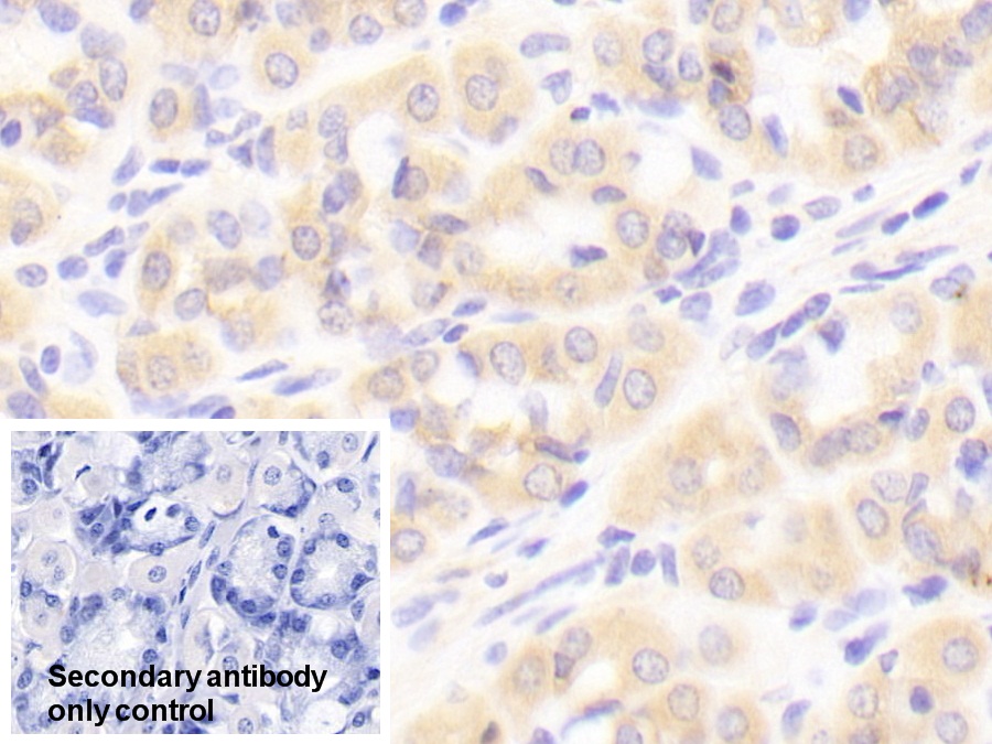 Polyclonal Antibody to Inhibitory Subunit Of NF Kappa B Alpha (IkBa)