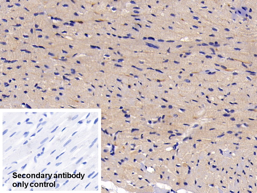 Polyclonal Antibody to Inhibitory Subunit Of NF Kappa B Alpha (IkBa)